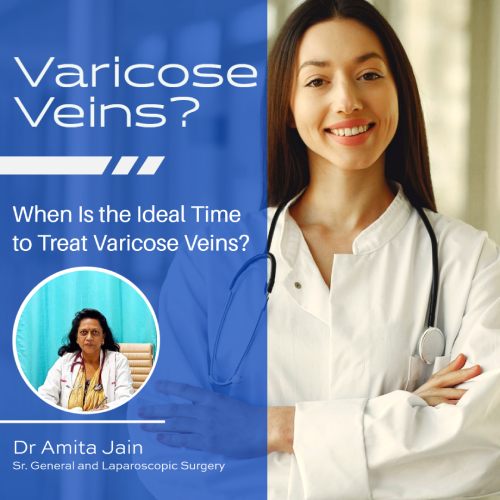 best laparoscopic surgeon in Delhi for vericose veins