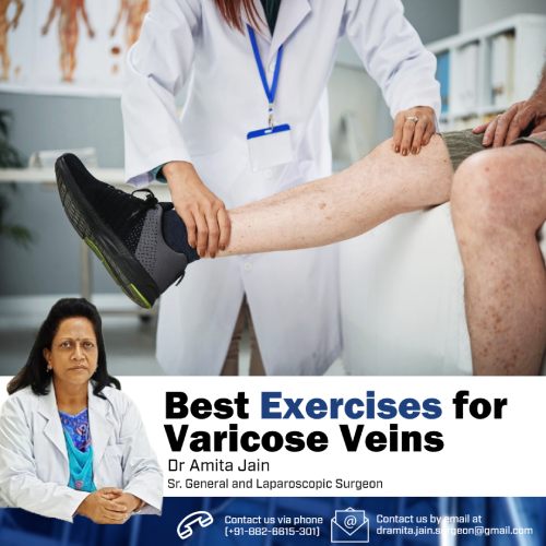 best vericose vein surgeon in Delhi Dr Amita Jain