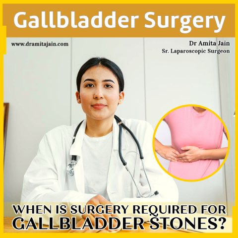 When removal of gallbladder is required