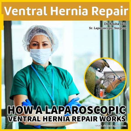 ventral hernia repair surgeon by Dr Amita Jain