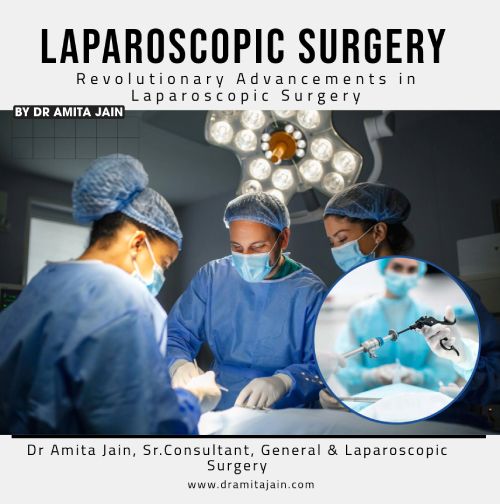 Revolutionary Advancements in Laparoscopic Surgery by Dr Amita Jain