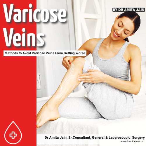 Dr Amita Jain top laparoscopic surgeon for varicose veins in India