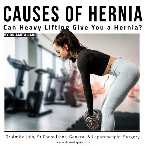 best hernia specialist doctor Dr Amita Jain