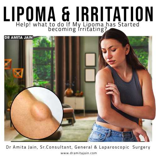 Best laparoscopic surgeon in delhi for lipoma_dr. amita jain