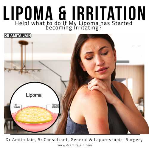 best laparoscopic surgeon for lipoma in delhi_dr. amita jain