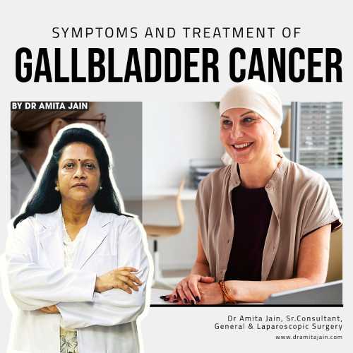 gallstones doctor in delhi_dr.amita jain