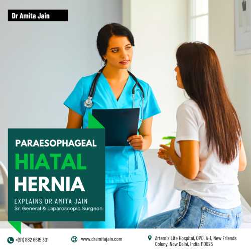 hernia specialist in delhi_dr. amita jain