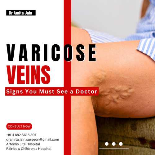 dr amita jain_varicose veins surgeon in delhi