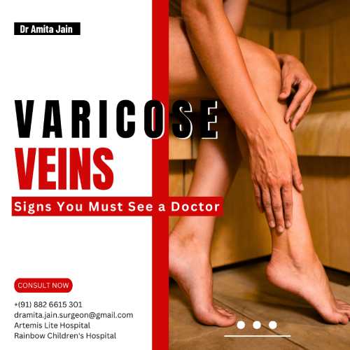 dr. amita jain_varicose veins in delhi and gurgaon