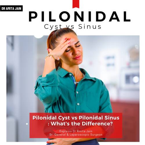 dr amita jain pilonidal sinus surgeon in delhi