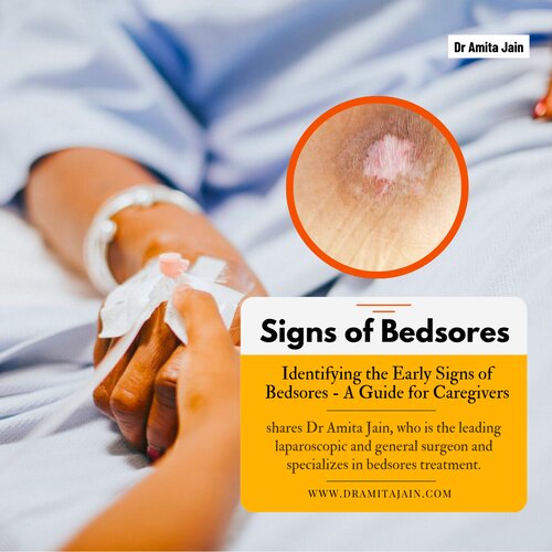 How do we identify the early signs of bedsores? explains, Dr Amita Jain, the leading surgeon and doctor in Delhi and Gurgaon for bedsores treatment