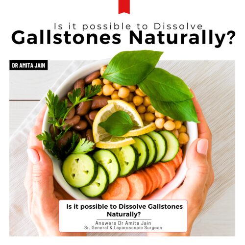 Gallbladder stone surgeon blog image