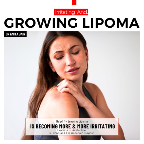 Lipoma specialist in Delhi Dr Amita Jain