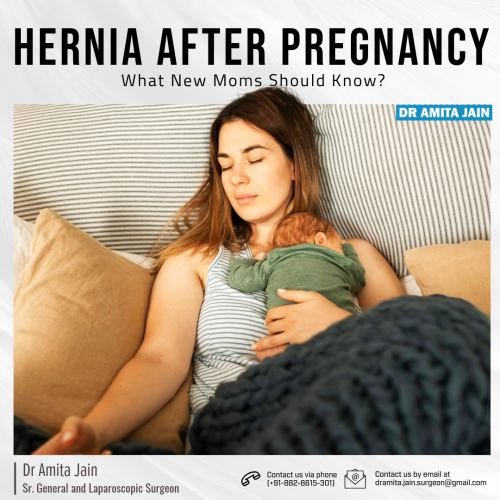 best hernia specialist doctor in Delhi