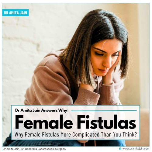 Dr Amita Jain top female doctor for fistula treatment