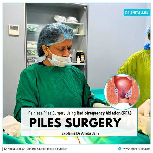 grade one piles surgery and treatment in Delhi by Dr Amita Jain