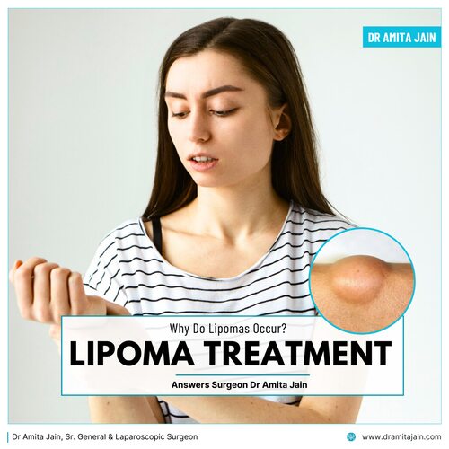 Lipoma treatment in Delhi Dr Amita Jain